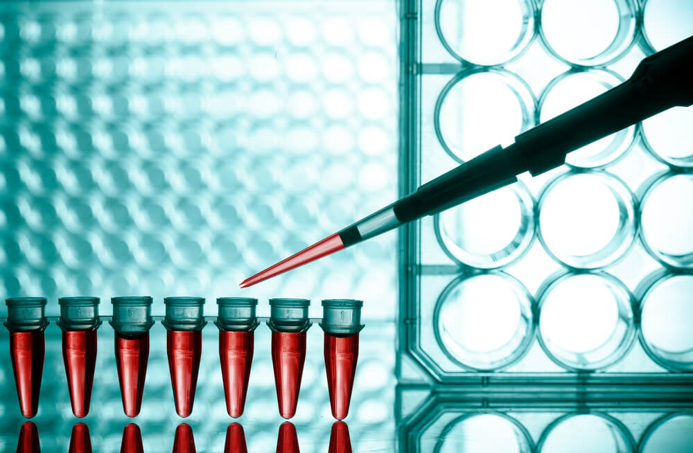 Why Routine Blood Testing is Important Part to Maintaining Your Health